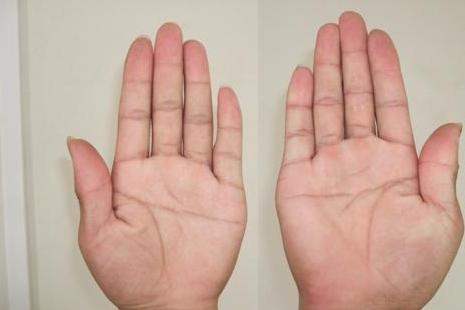 斷掌紋的男人如何做命運贏家男人斷掌手相圖解